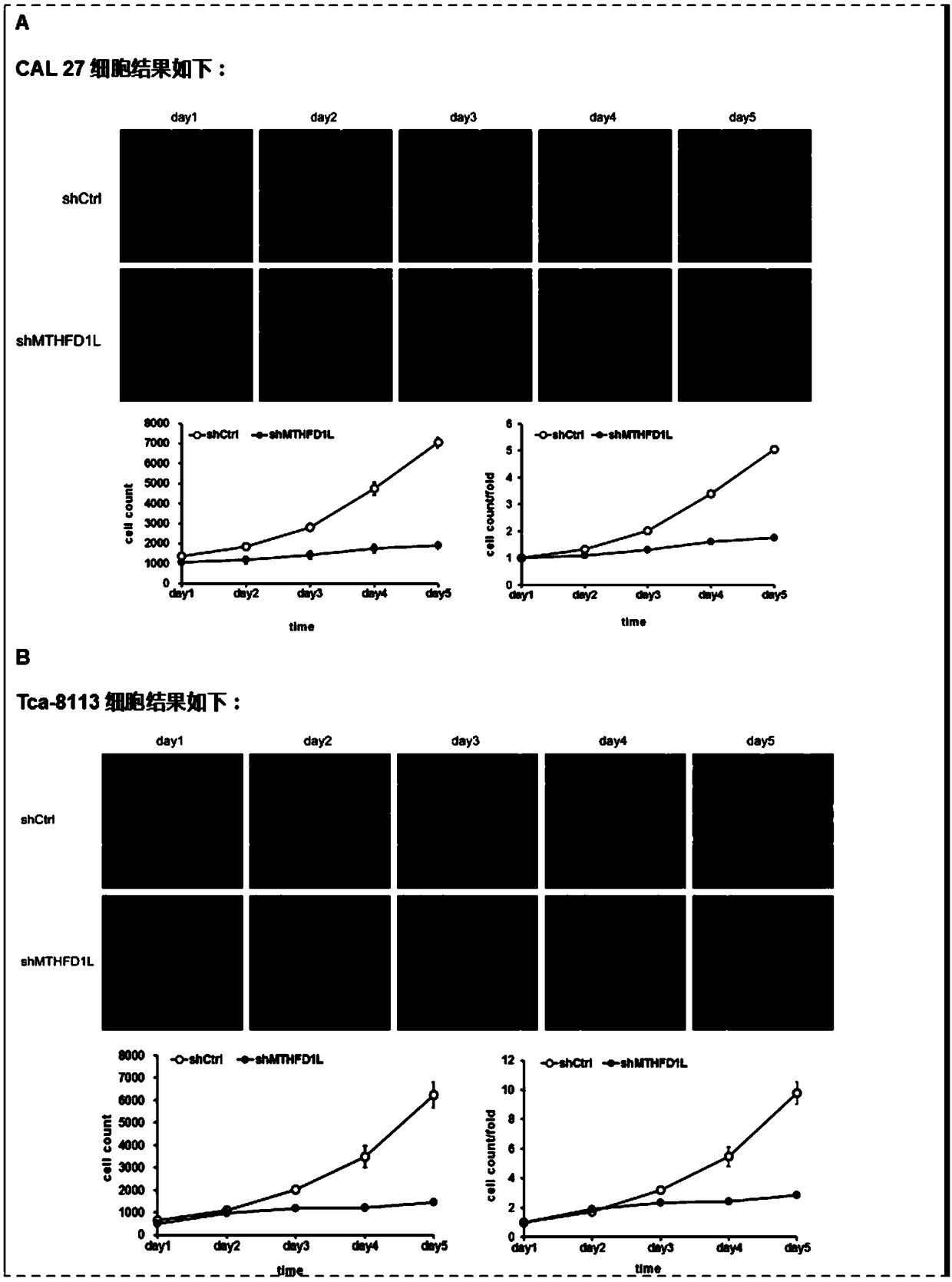 Application of MTHFD1L (methylenetetrahydrofolate dehydrogenase (NADP+dependent)1like) inhibitor to preparation of tongue squamous cell carcinoma treatment medicament