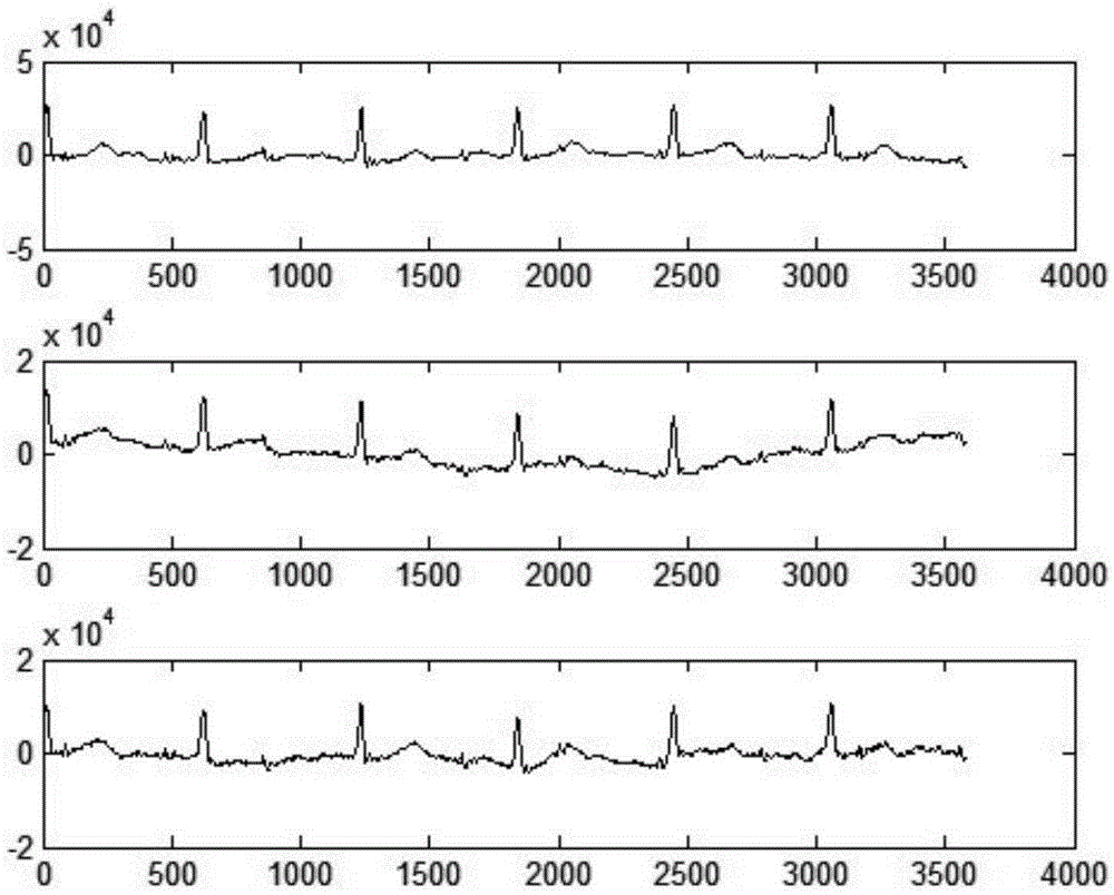 Fetal electrocardiogram blind separation method based on low signal-to-noise ratio