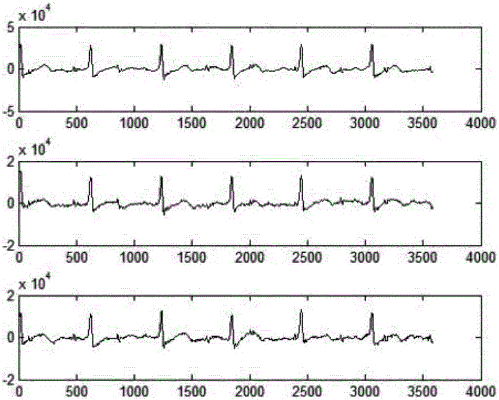Fetal electrocardiogram blind separation method based on low signal-to-noise ratio