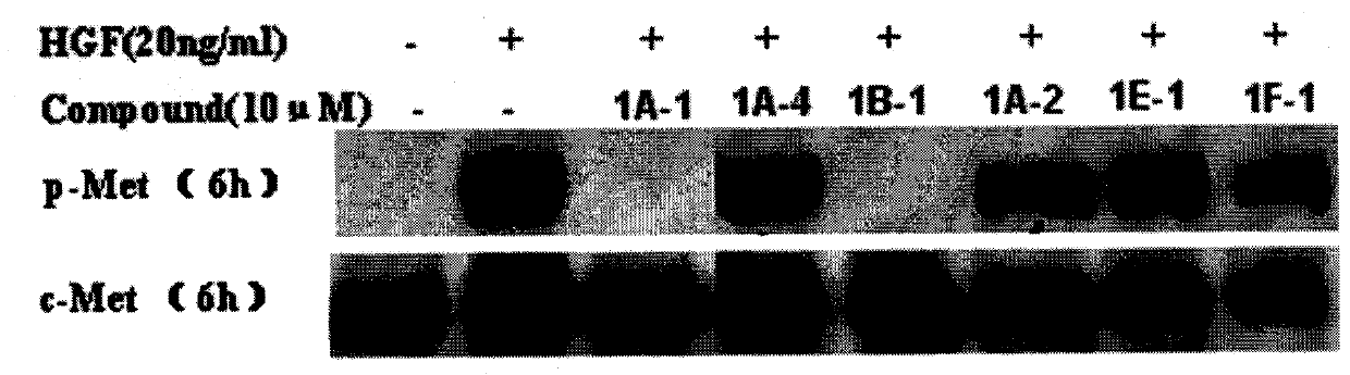 Quinoline compound and preparation method thereof, medicament combination containing compound and application of compound
