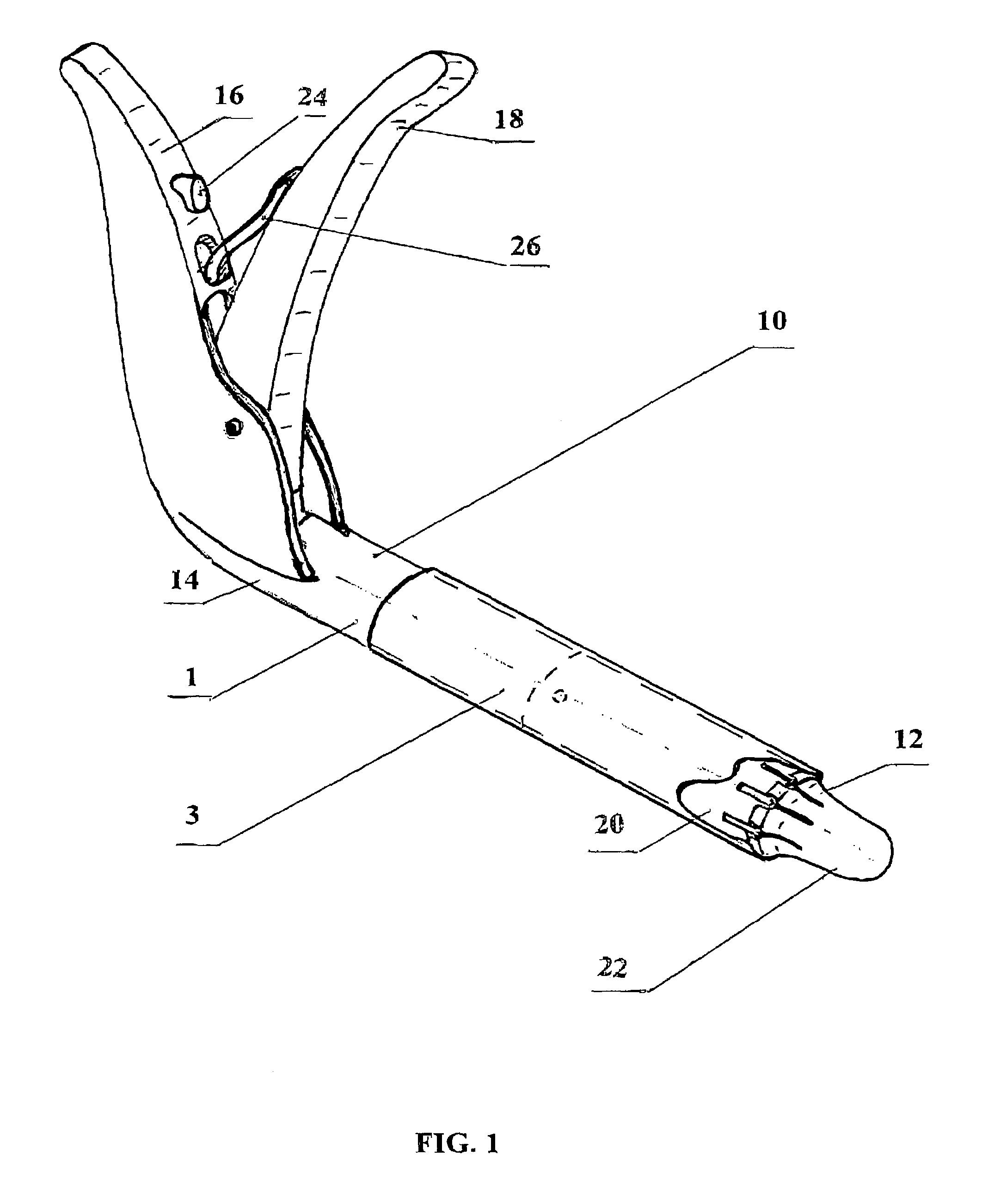 Method and apparatus for intraluminal fixation of intravascular devices