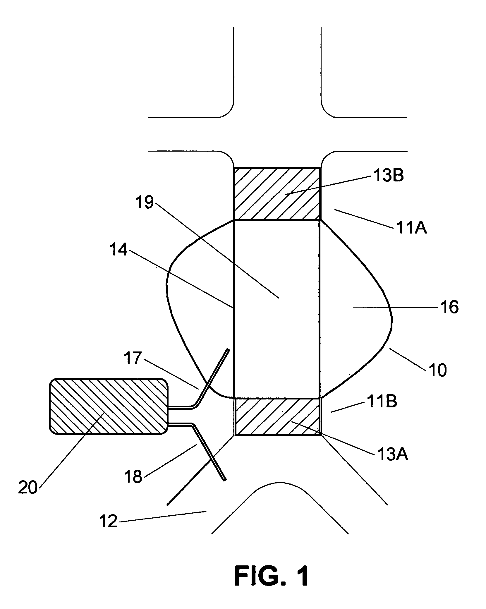 Implantable device for monitoring aneurysm sac parameters