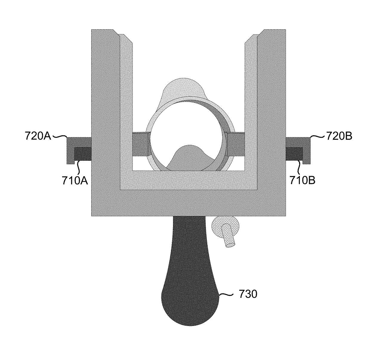 Device and apparatus to facilitate cervix cancer screening