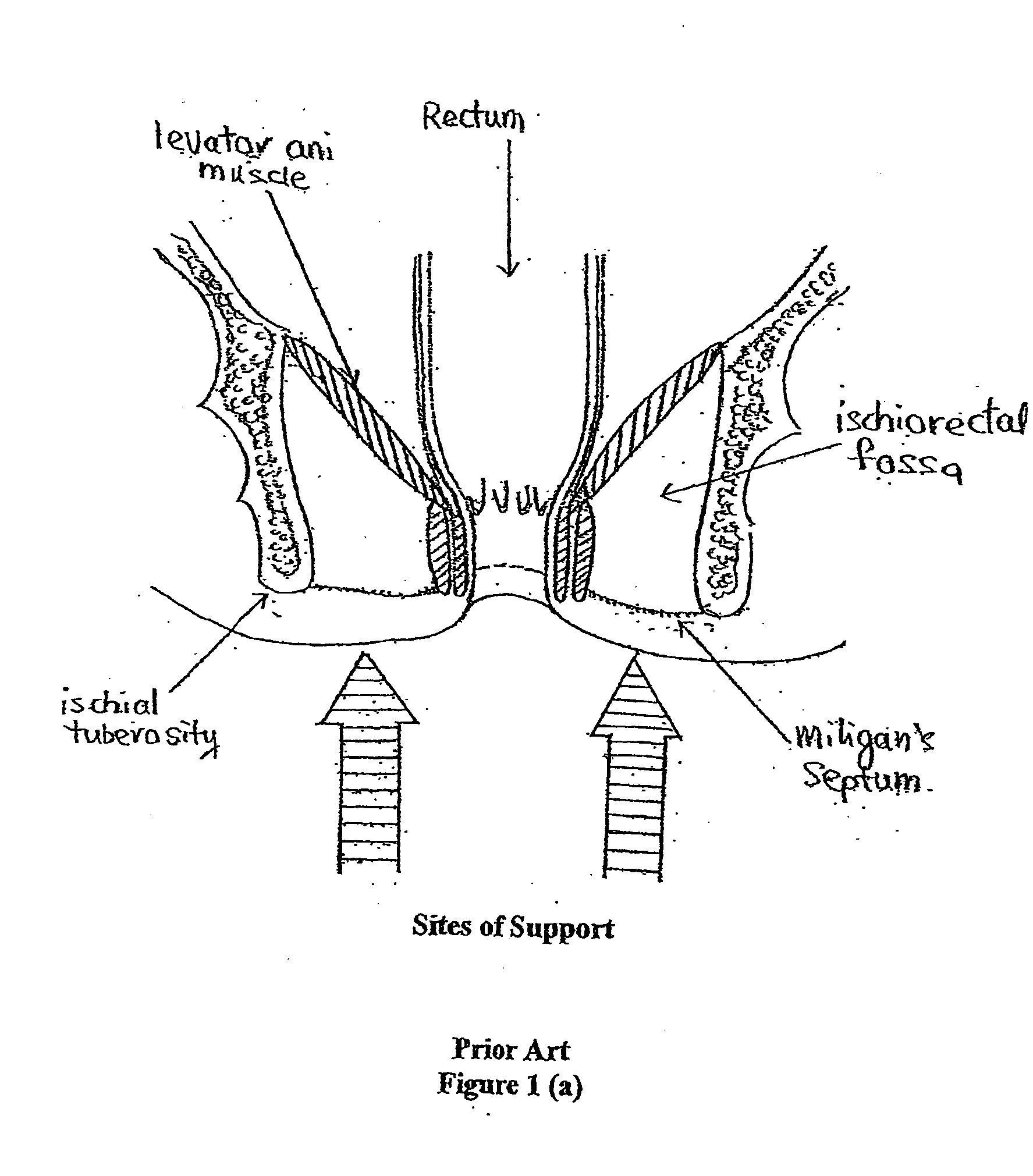 Toilet seat with anococcygeal support