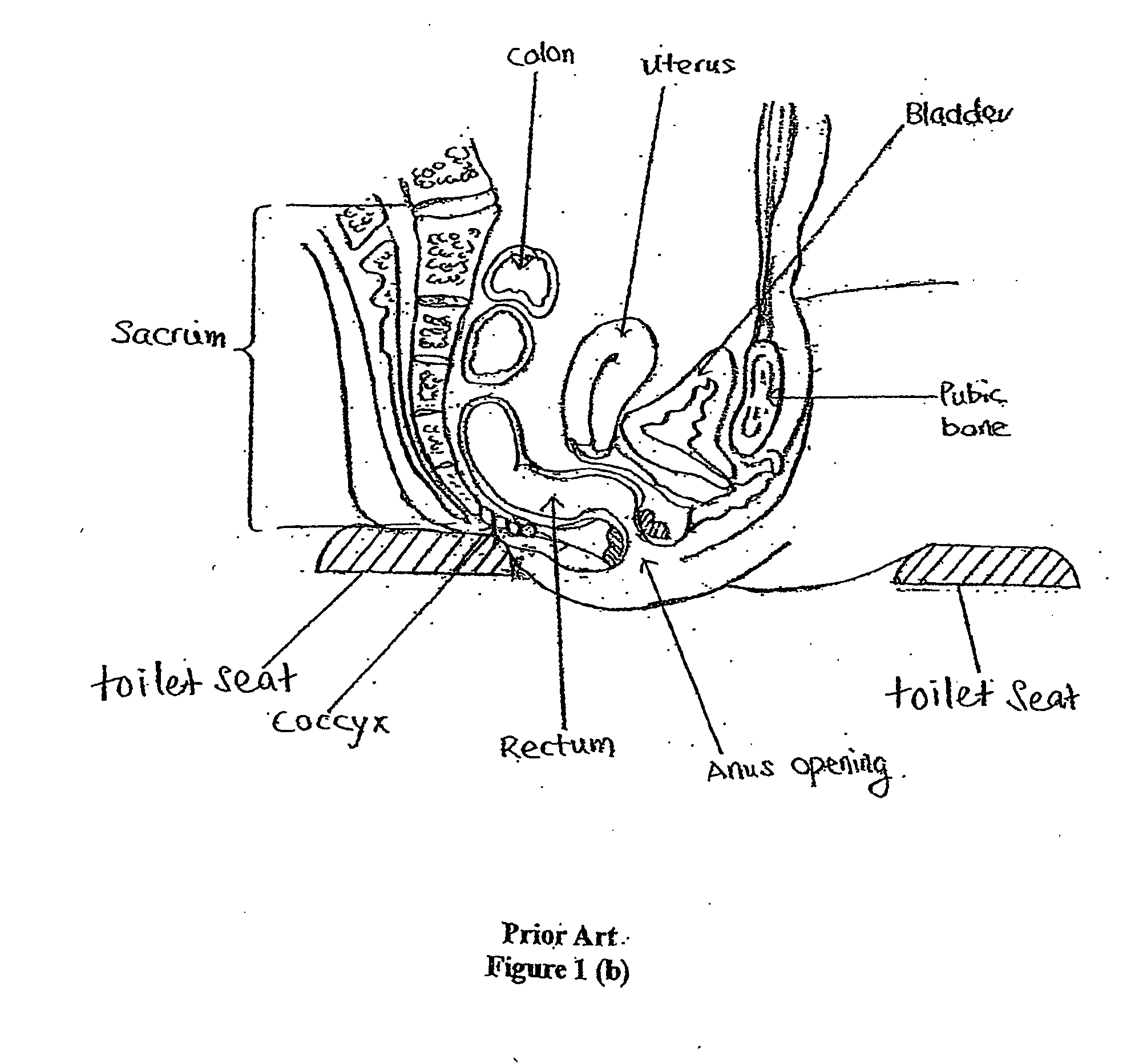 Toilet seat with anococcygeal support