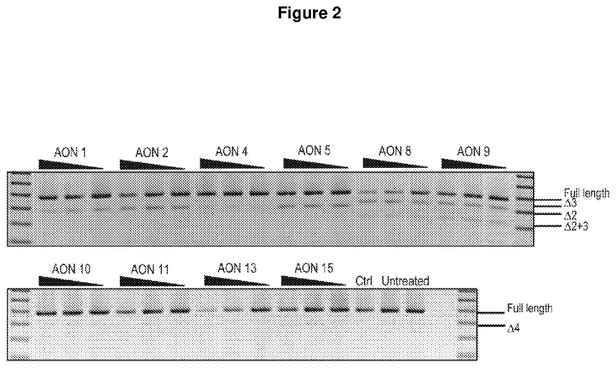 Treatment for sod1 associated disease