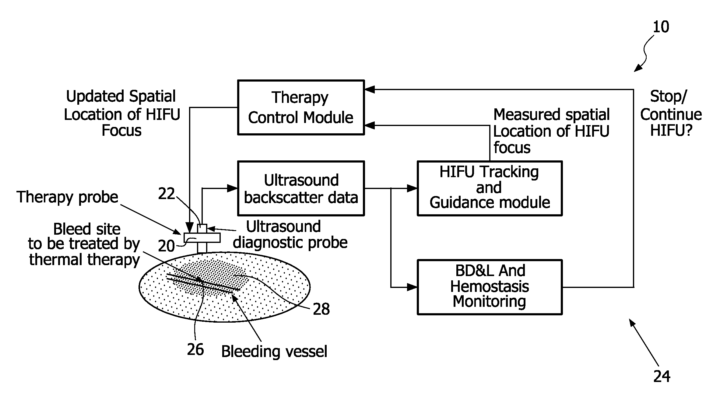 Systems and methods for tracking and guiding high intensity focused ultrasound beams