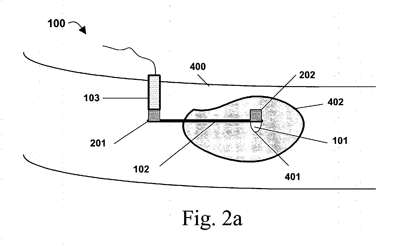 Method, system and device for tissue characterization