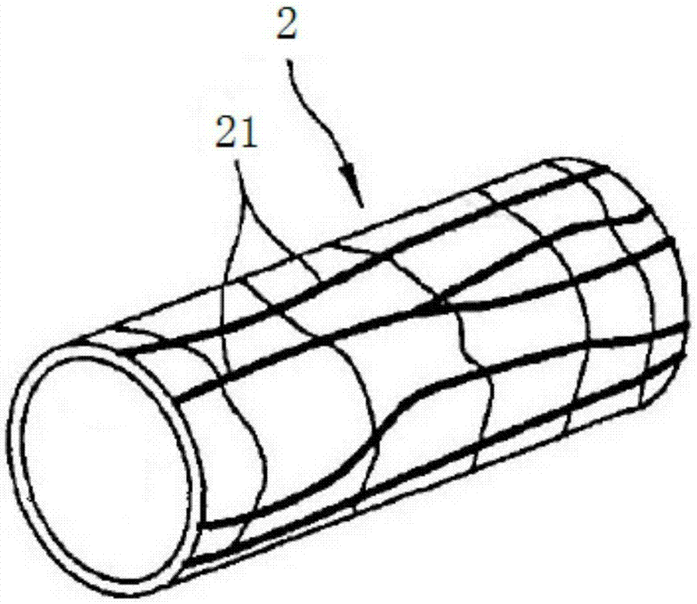 Renal artery radiofrequency ablation catheter