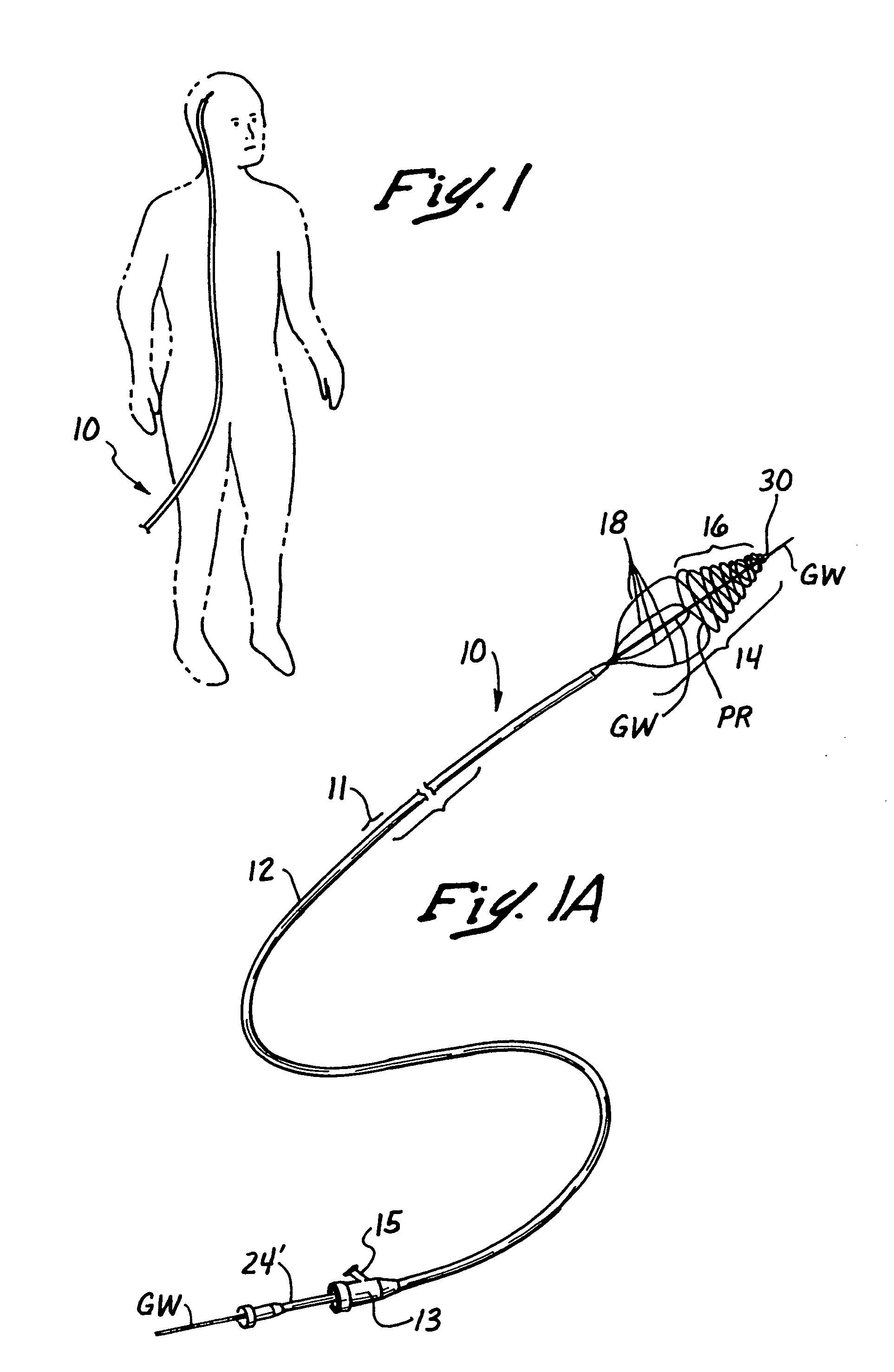 Embolectomy catheters and methods for treating stroke and other small vessel thromboembolic disorders