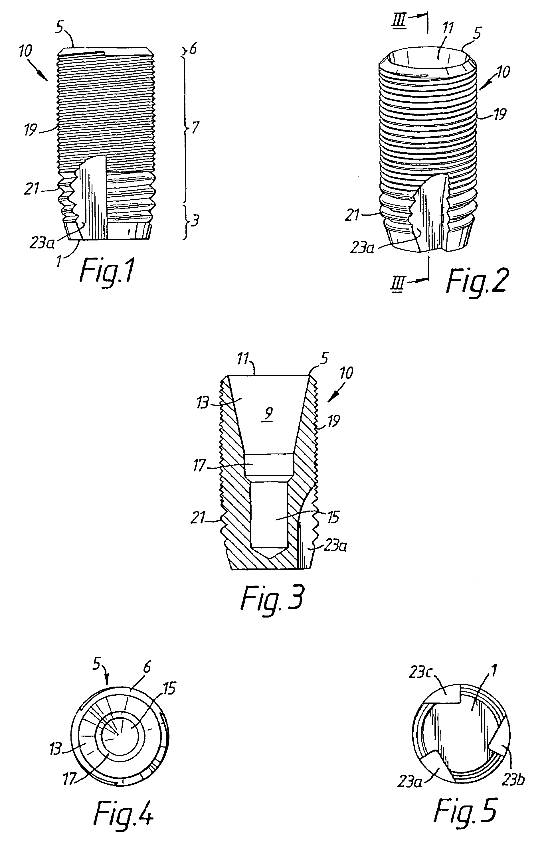 Implant having circumferentially oriented roughness