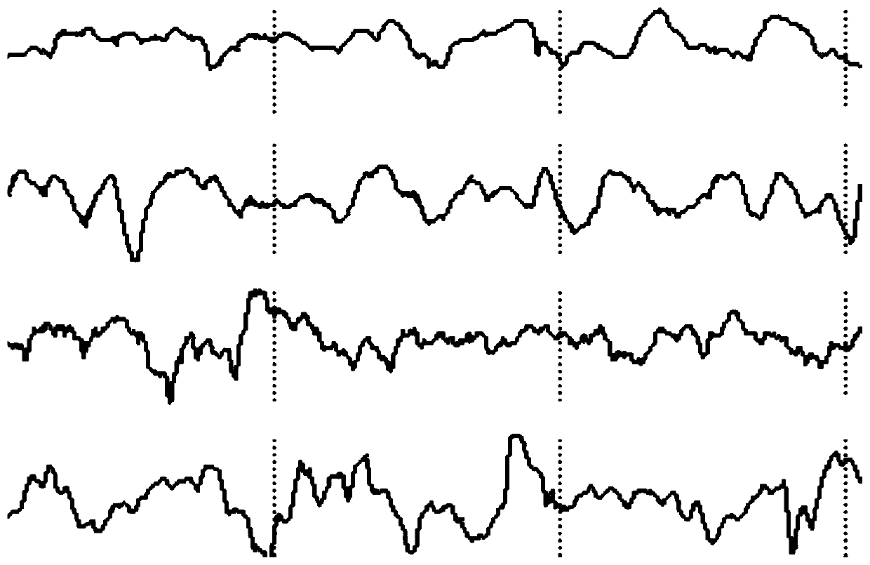 Ultralow-frequency EEG (electroencephalograph) detector and ultralow-frequency EEG detection and analysis method