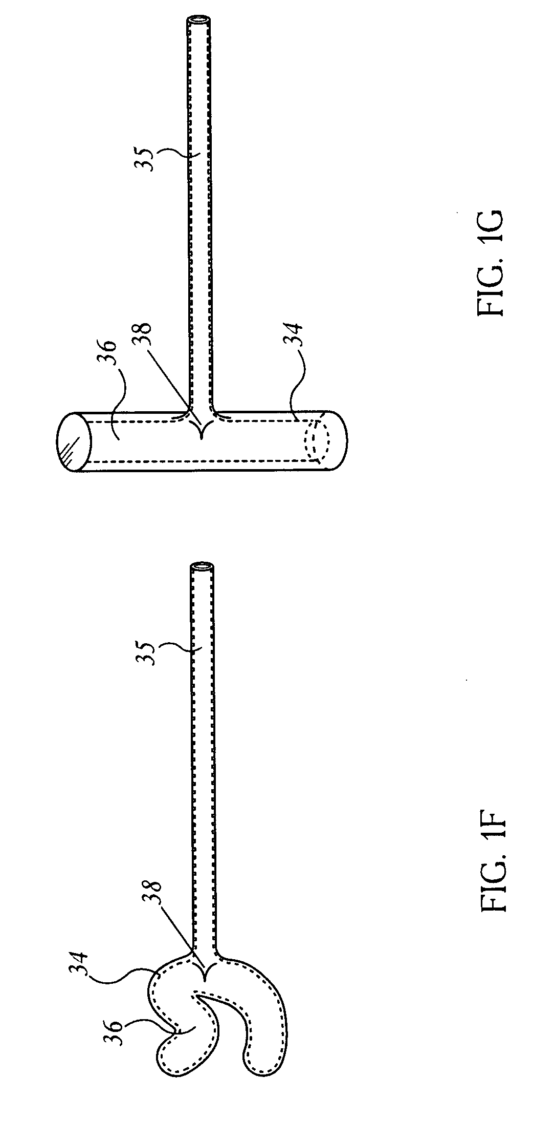 Methods and devices to facilitate connections between body lumens