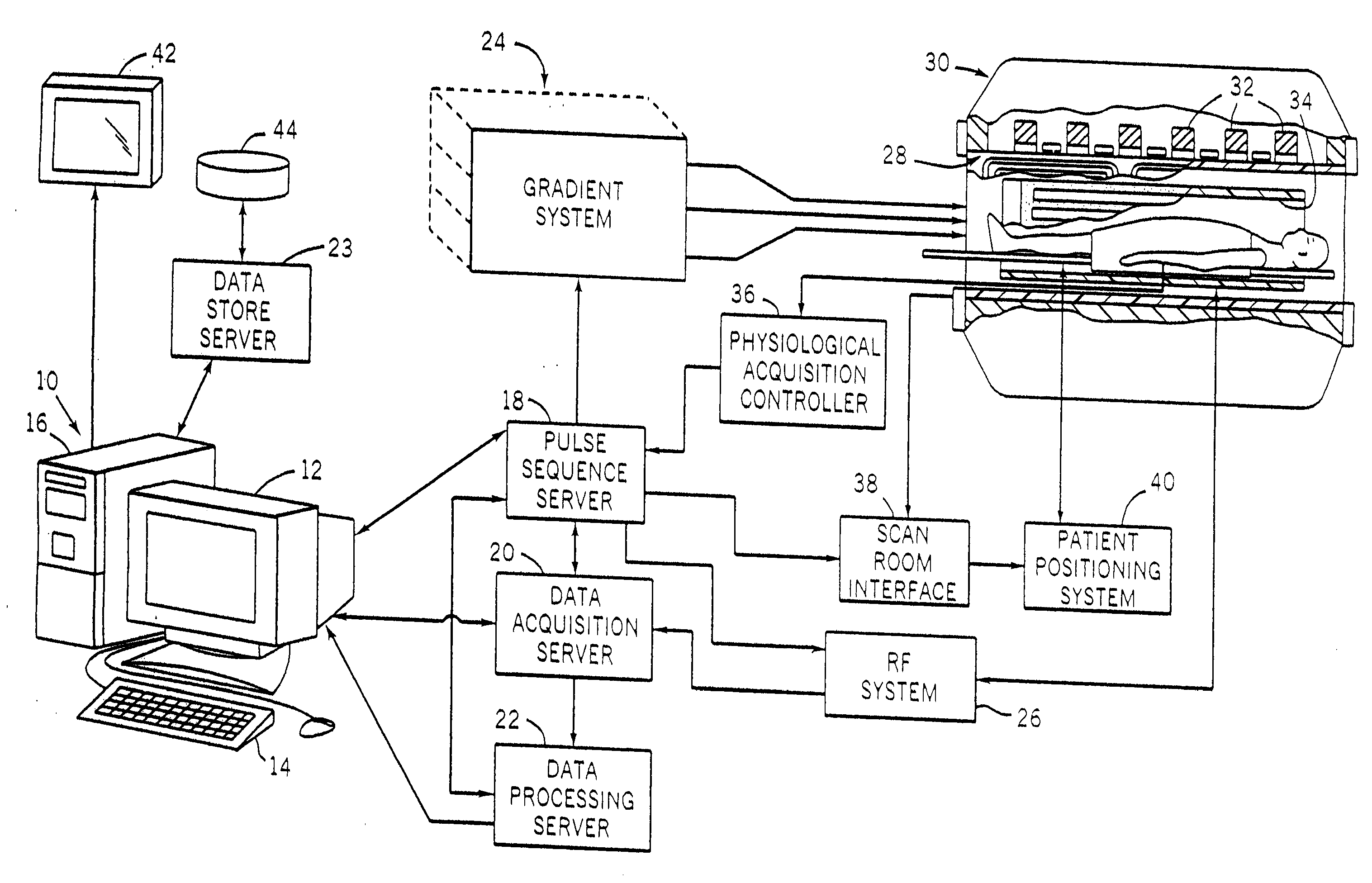 Accelerated Shells Trajectory MRI Acquisition