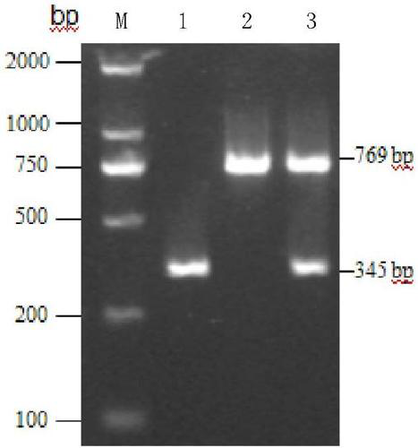 A method for rapid detection of Bacillus coagulans and multiplex PCR kit