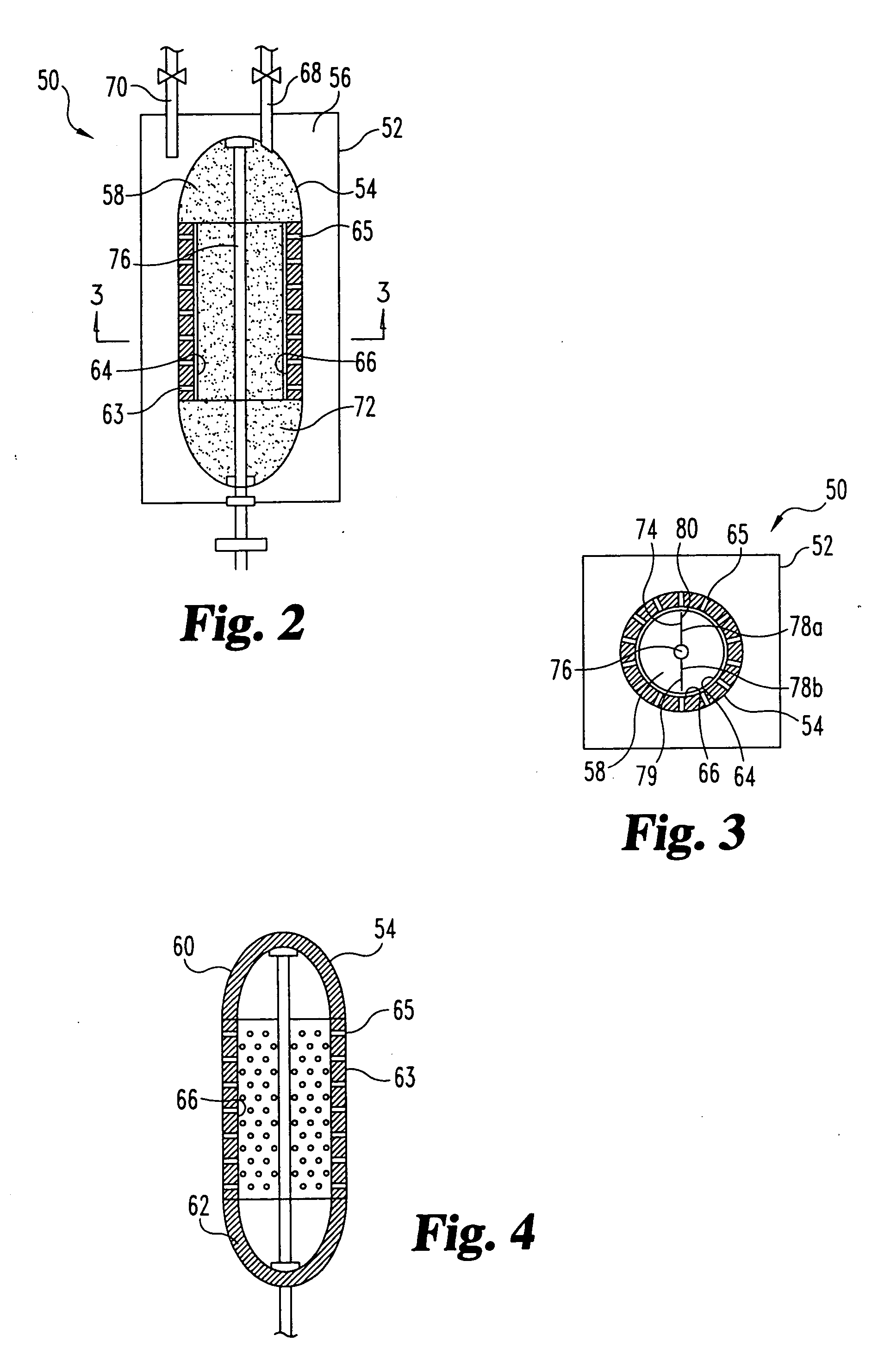 Sorbent reactor for extracorporeal blood treatment systems, peritoneal dialysis systems, and other body fluid treatment systems