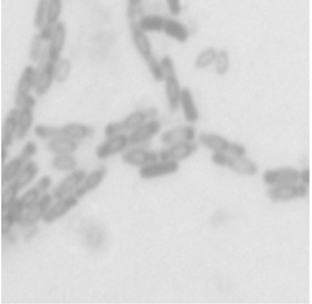 Bacillus thuringiensis GL-1 and application thereof in phosphate solubilization and disease prevention of soil