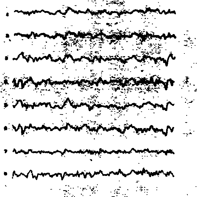 Method for forming brain scalp electric potential information chart