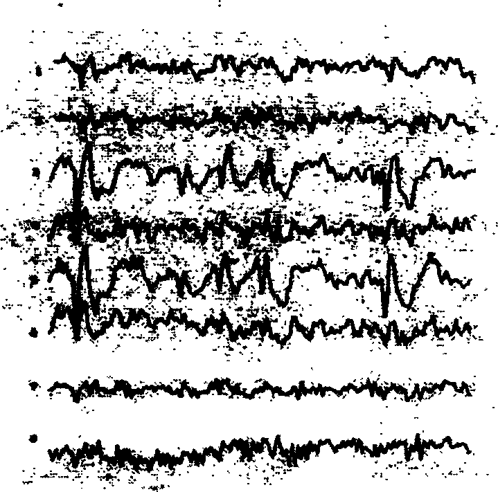 Method for forming brain scalp electric potential information chart