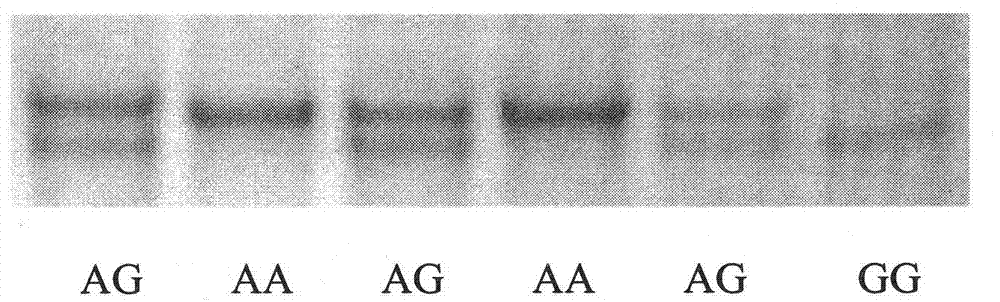 Single nucleotide polymorphism of ox TAS1R2 gene and detecting method thereof