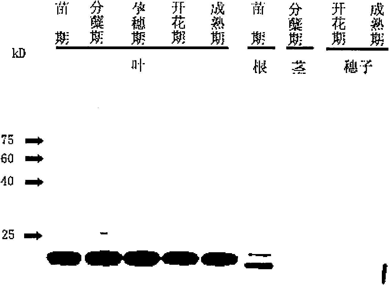 Acyl carrier protein III epitope, acyl carrier protein III antibody and use thereof