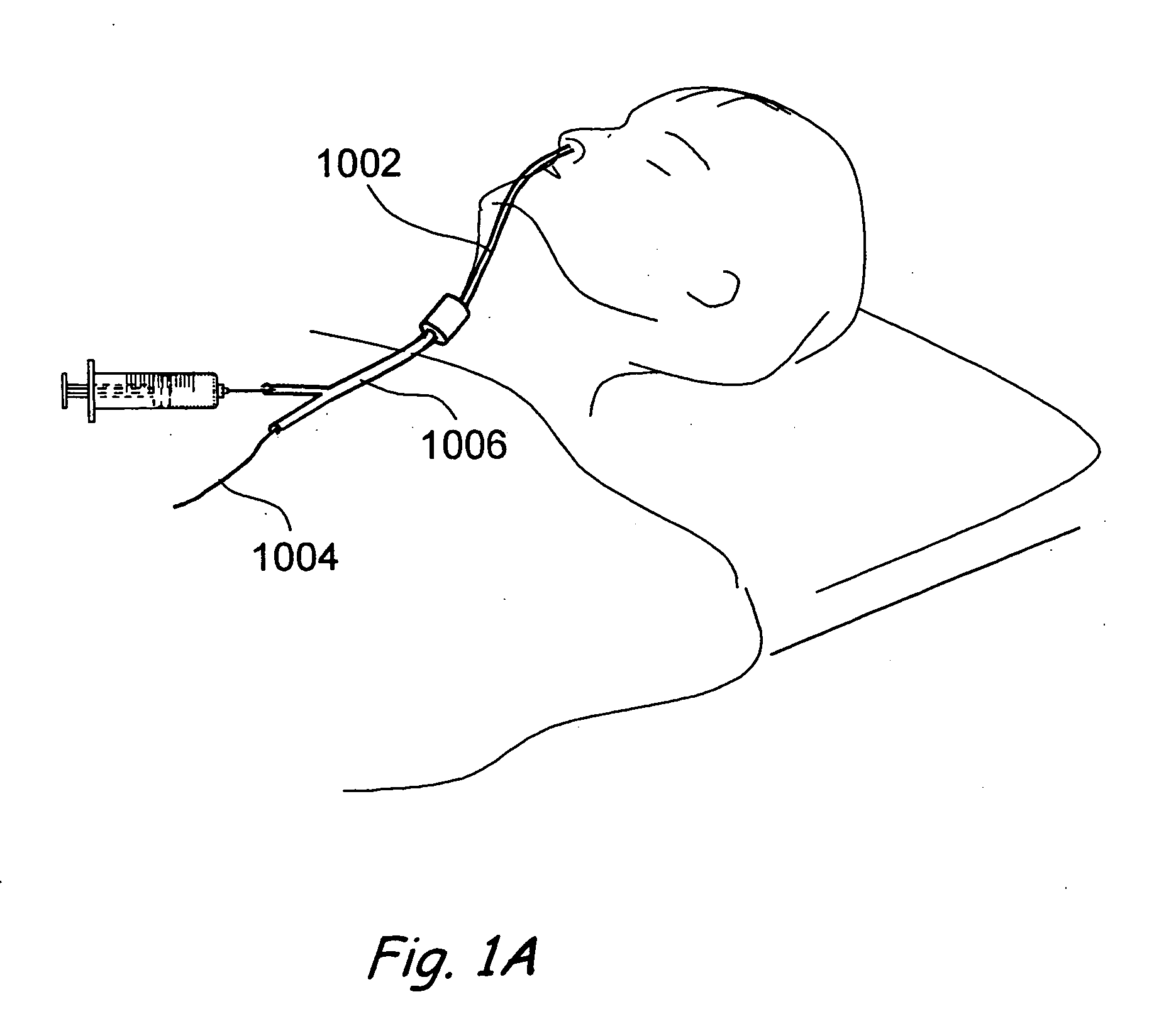 Apparatus and methods for dilating and modifying ostia of paranasal sinuses and other intranasal or paranasal structures