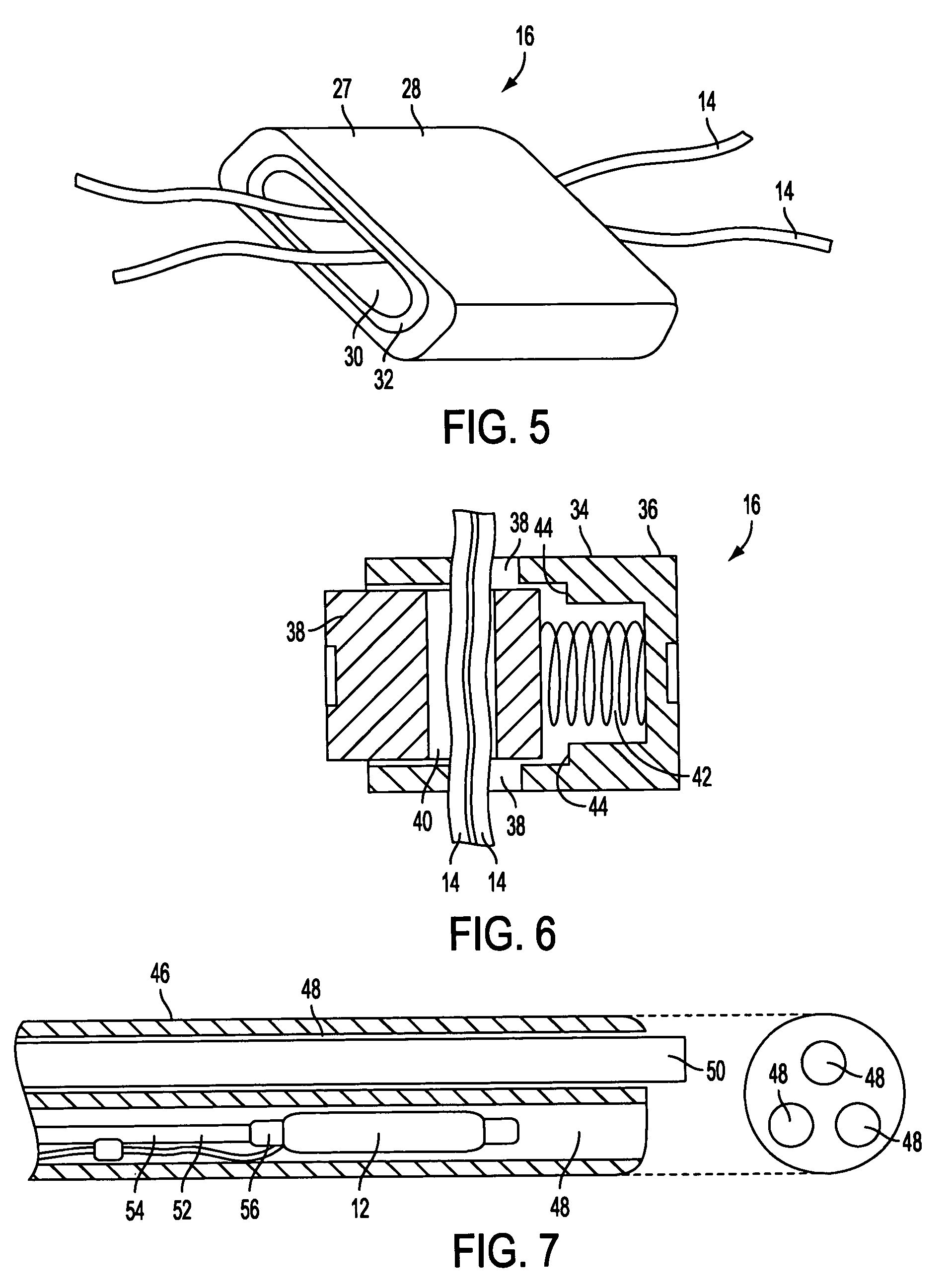Implantable artificial partition and methods of use