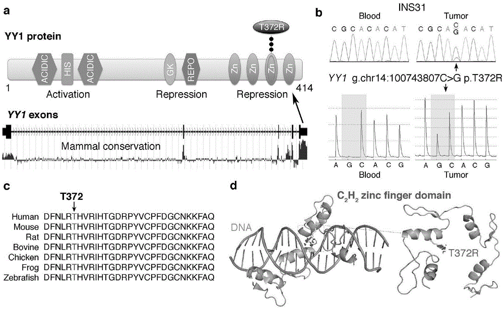 Pancreatic neuroendocrine tumor susceptibility gene locus and detection method and kit