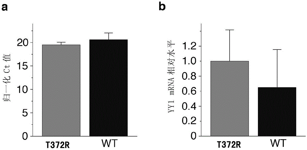 Pancreatic neuroendocrine tumor susceptibility gene locus and detection method and kit