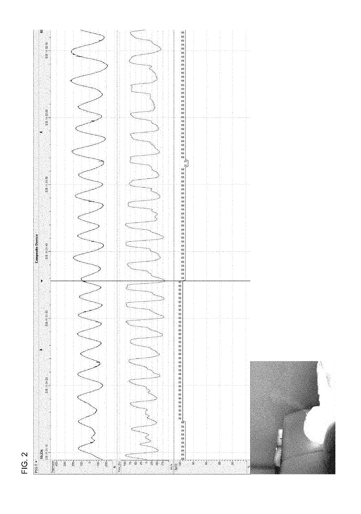Breath analysis system using gas image detection method