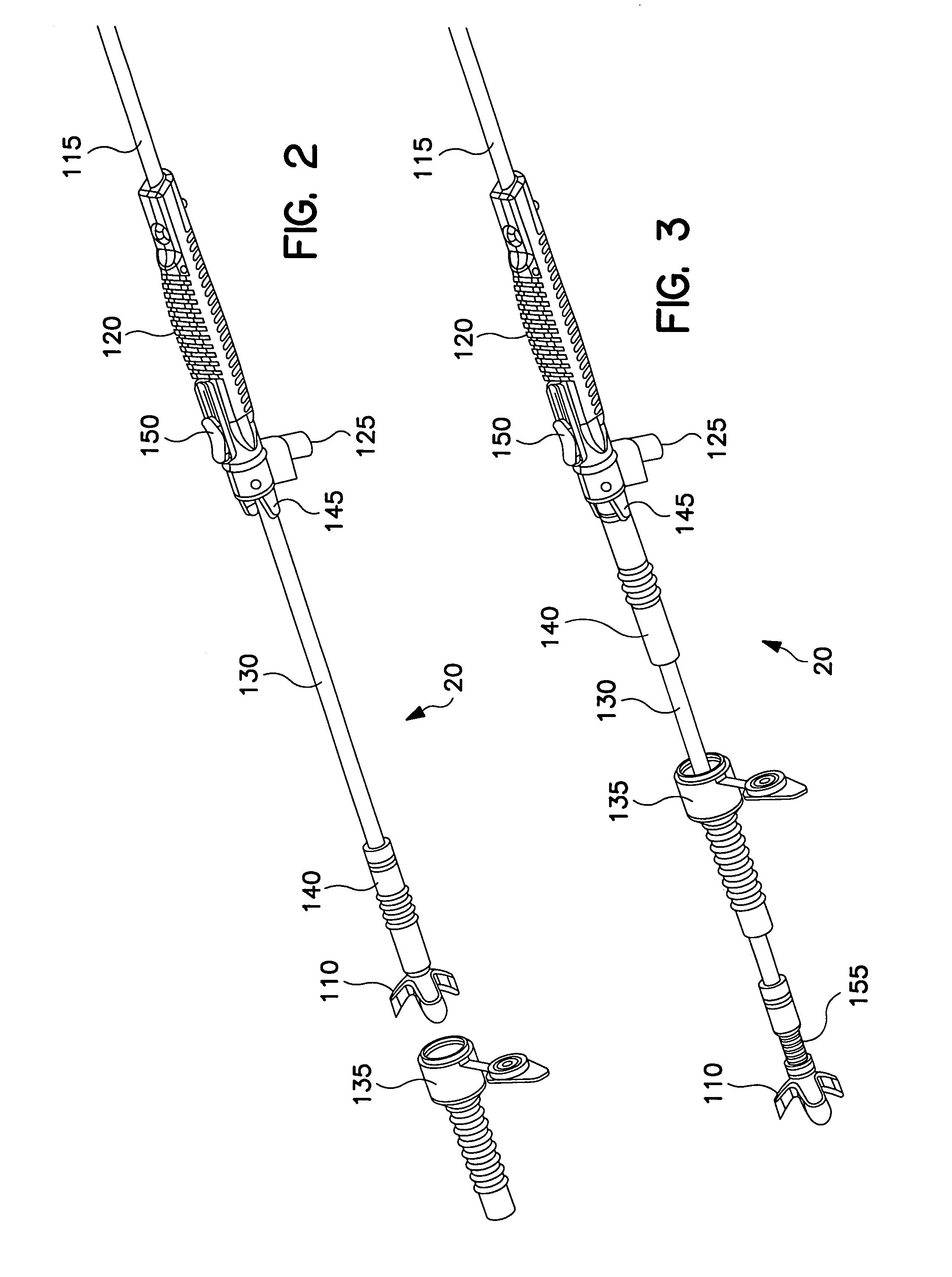 Method and system for organ positioning and stabilization