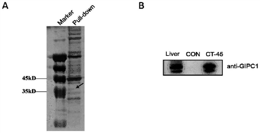 SiRNA for silencing GIPC1 gene, recombinant vector and application of siRNA and recombinant vector