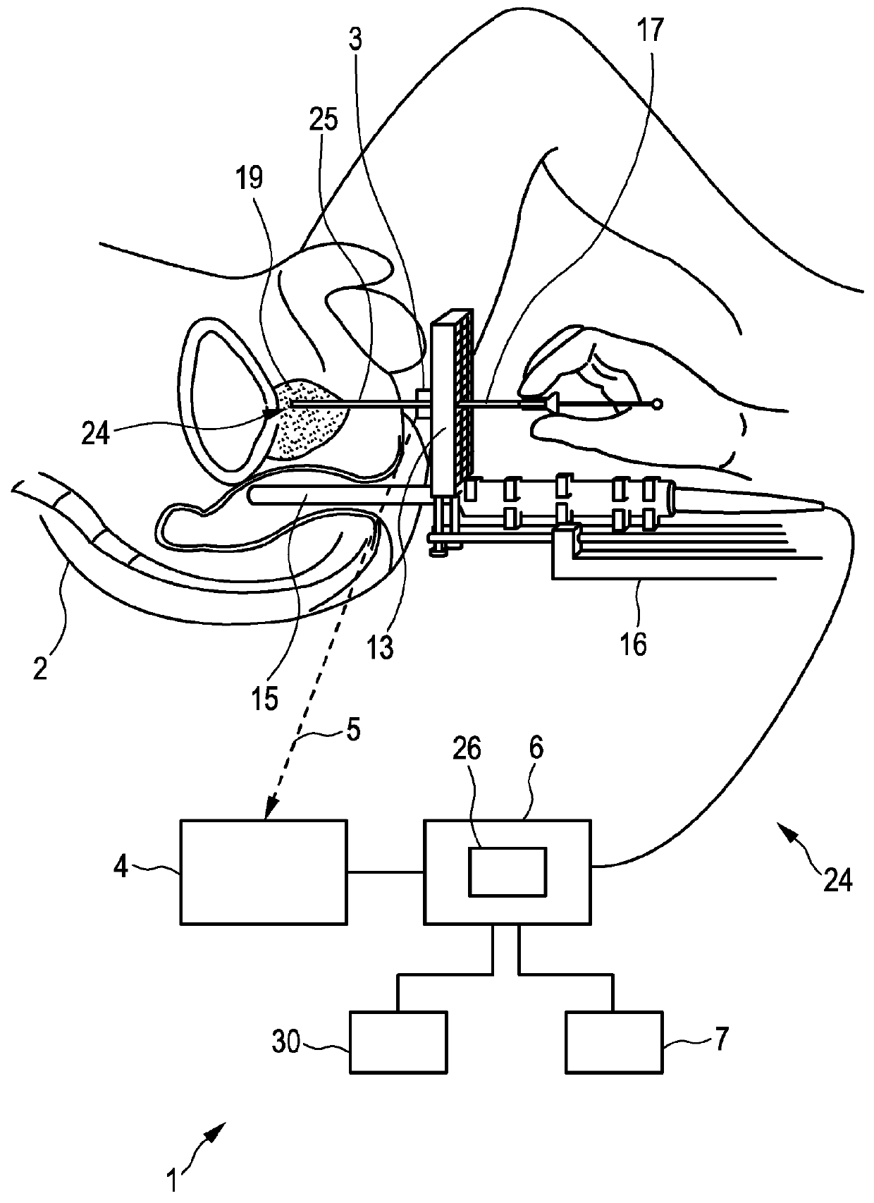 Imaging apparatus for brachytherapy or biopsy