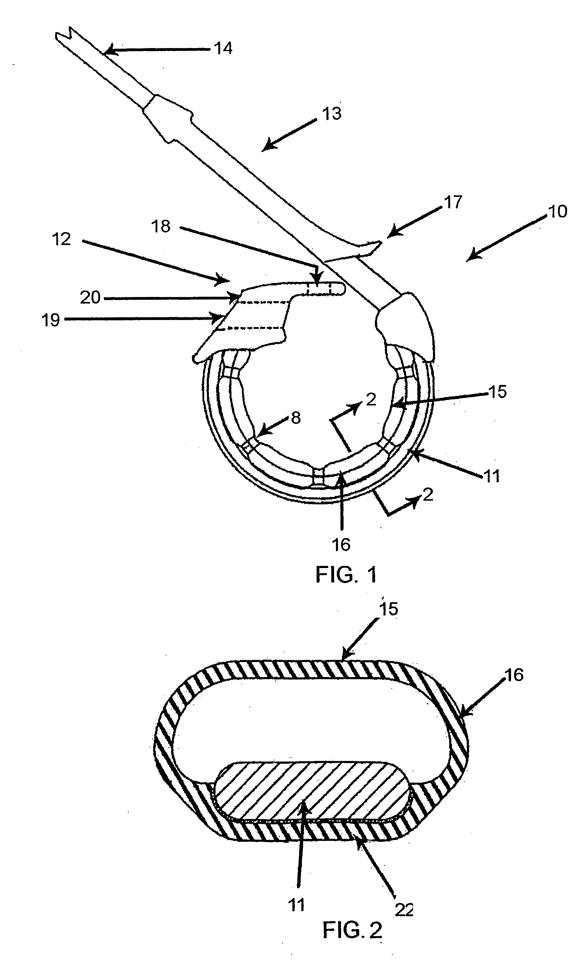 Fatigue-resistant gastric banding device