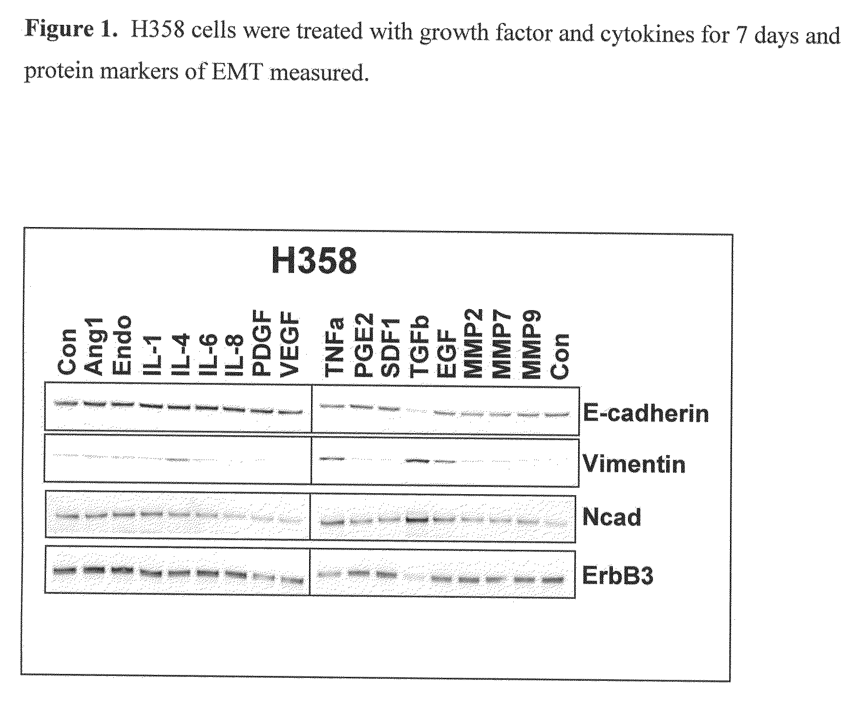 Methods for the identification of agents that inhibit mesenchymal-like tumor cells or their formation