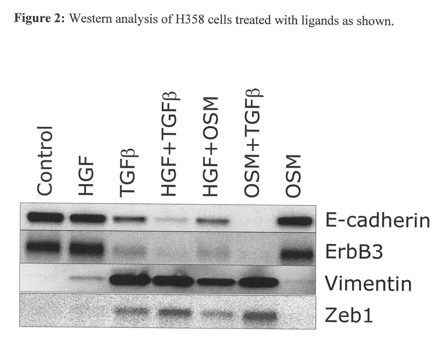Methods for the identification of agents that inhibit mesenchymal-like tumor cells or their formation