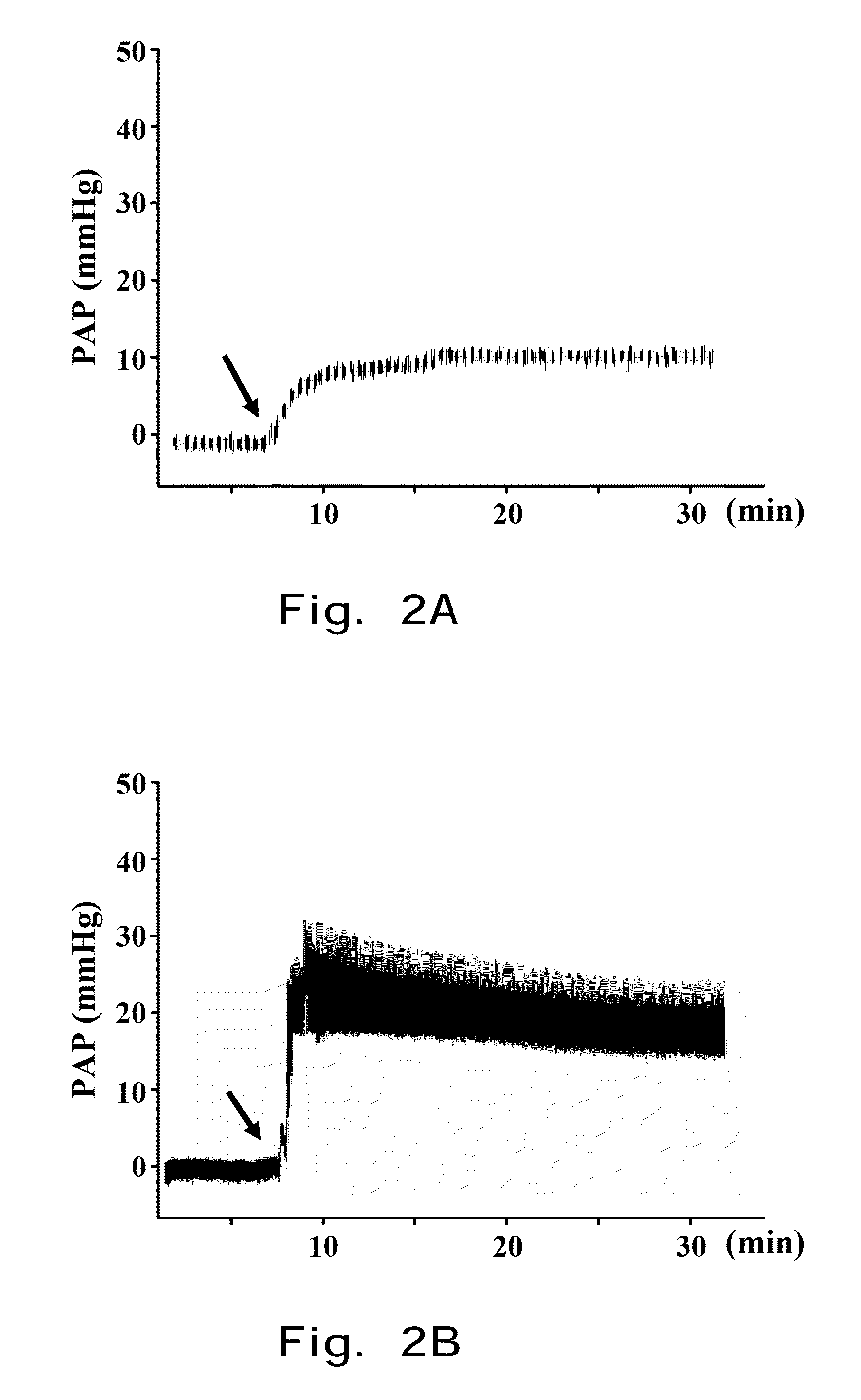 INHALED NO DONOR PIPERAZINYL DERIVATIVE PREVENTING ALLERGIC PULMONARY VASCULAR AND BRONCHIAL INFLAMMATION BY REDUCING VEGF AND RESTORING eNOS IN HYPOXIC PULMONARY ARTERY