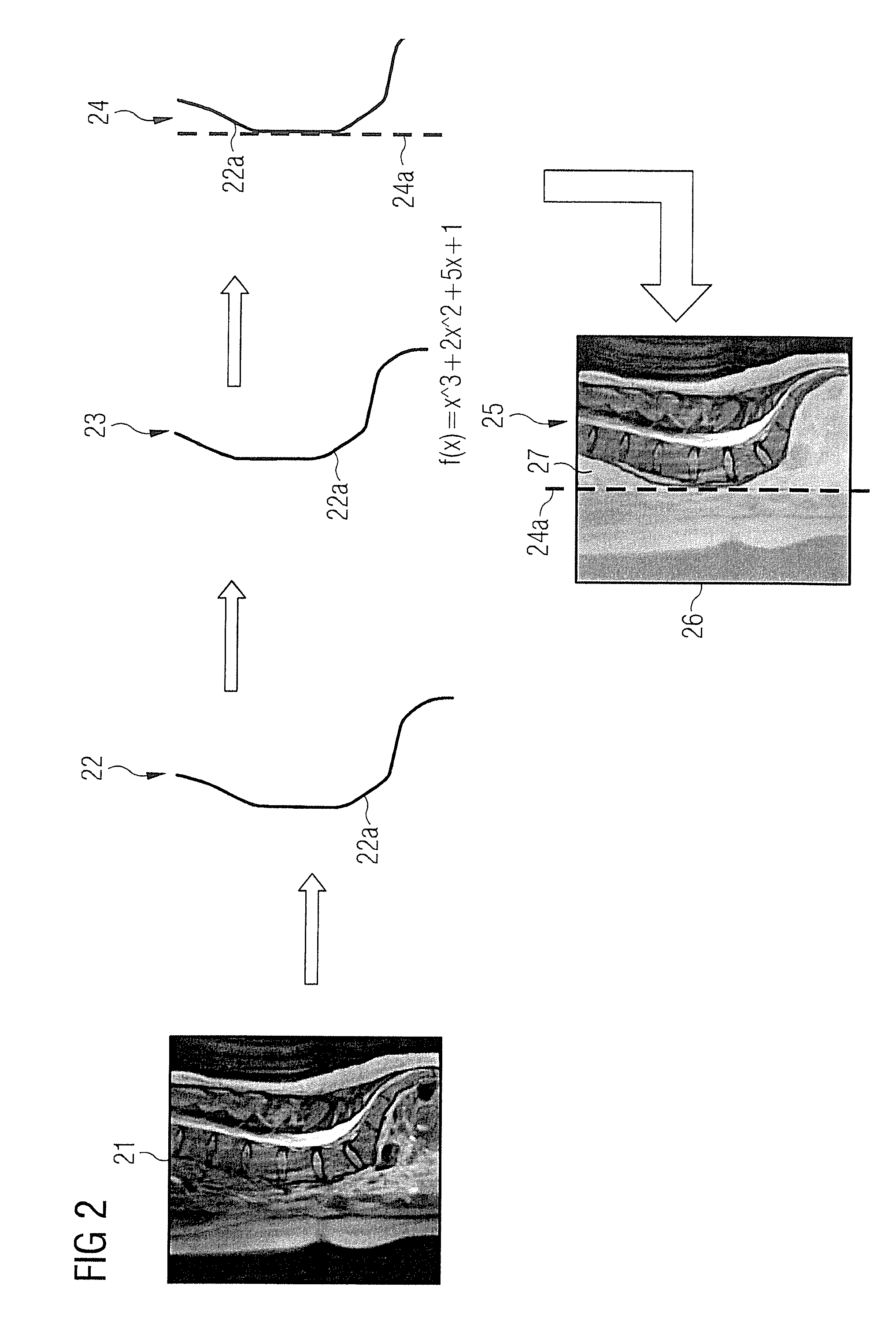 Magnetic resonance data acquisition method and apparatus saturation with spin dependent on the anatomical structures to be imaged