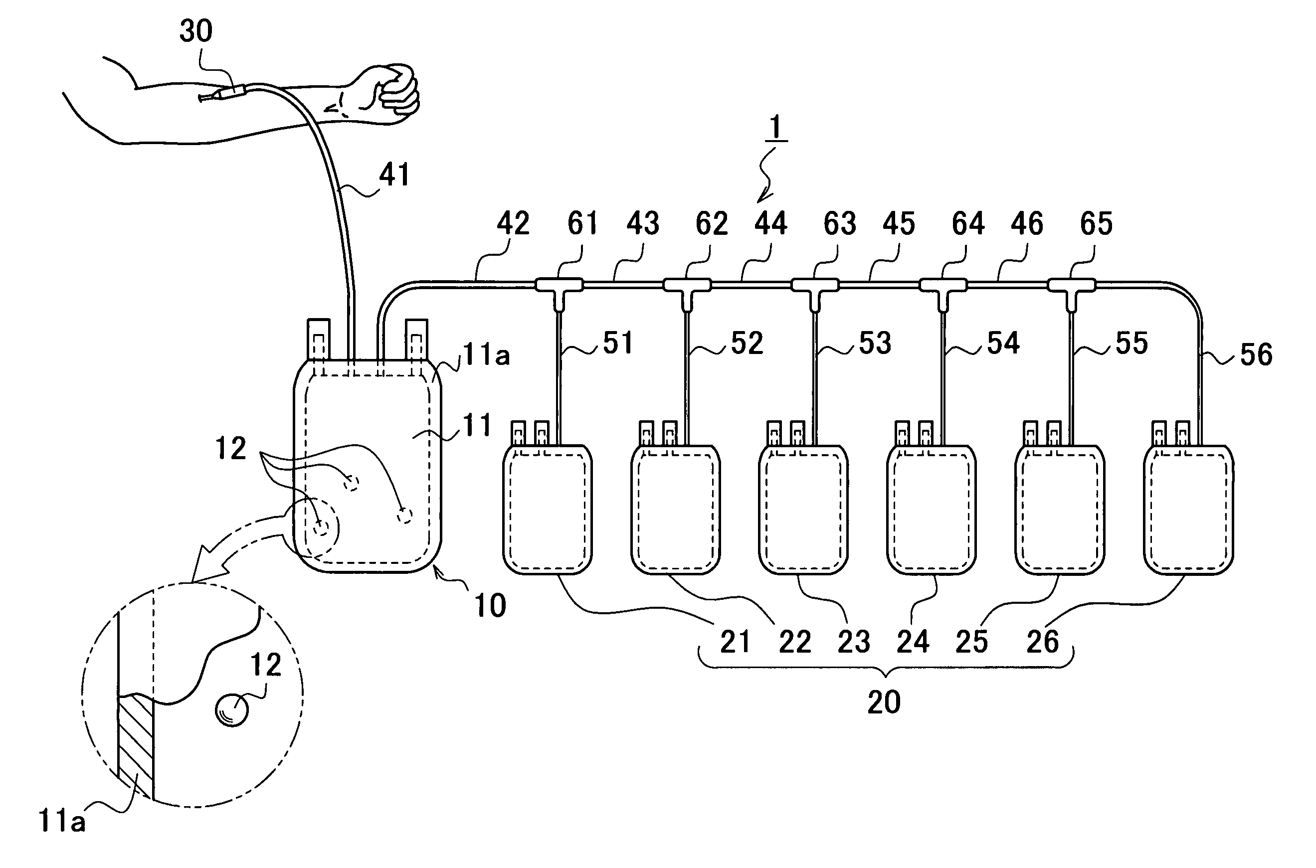 Container for preparing serum and regenerative medical process using the same
