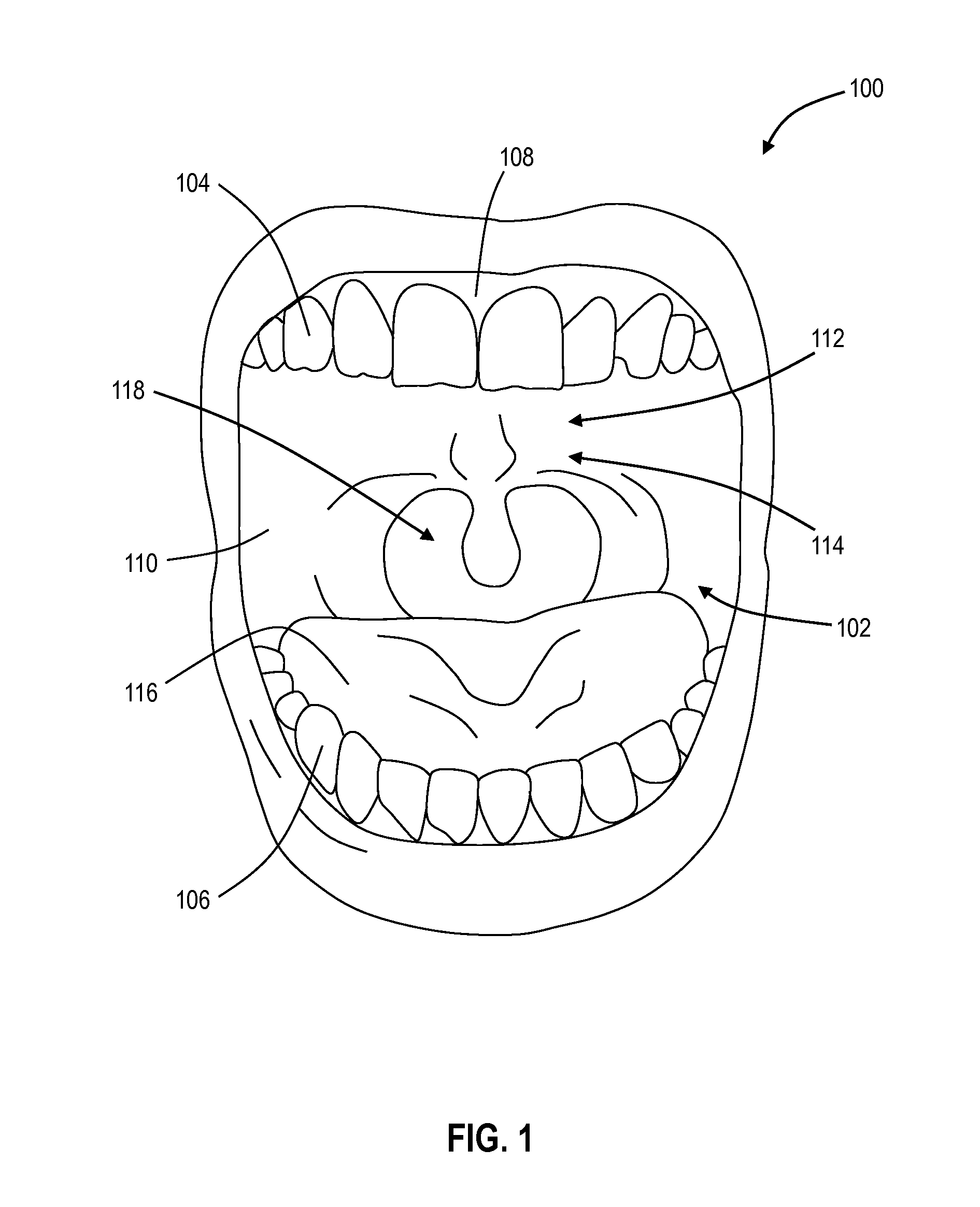 Dental trap