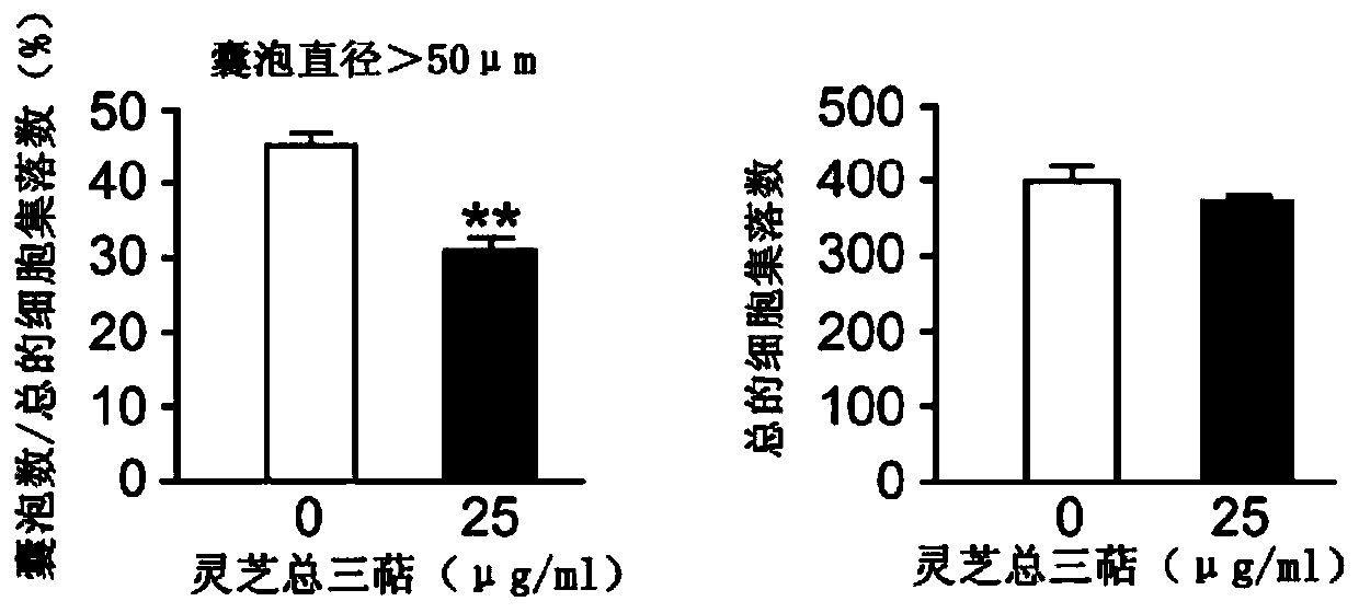 Application of Ganoderma lucidum extract and Ganoderma triterpene monomer in the treatment of autosomal dominant polycystic kidney disease