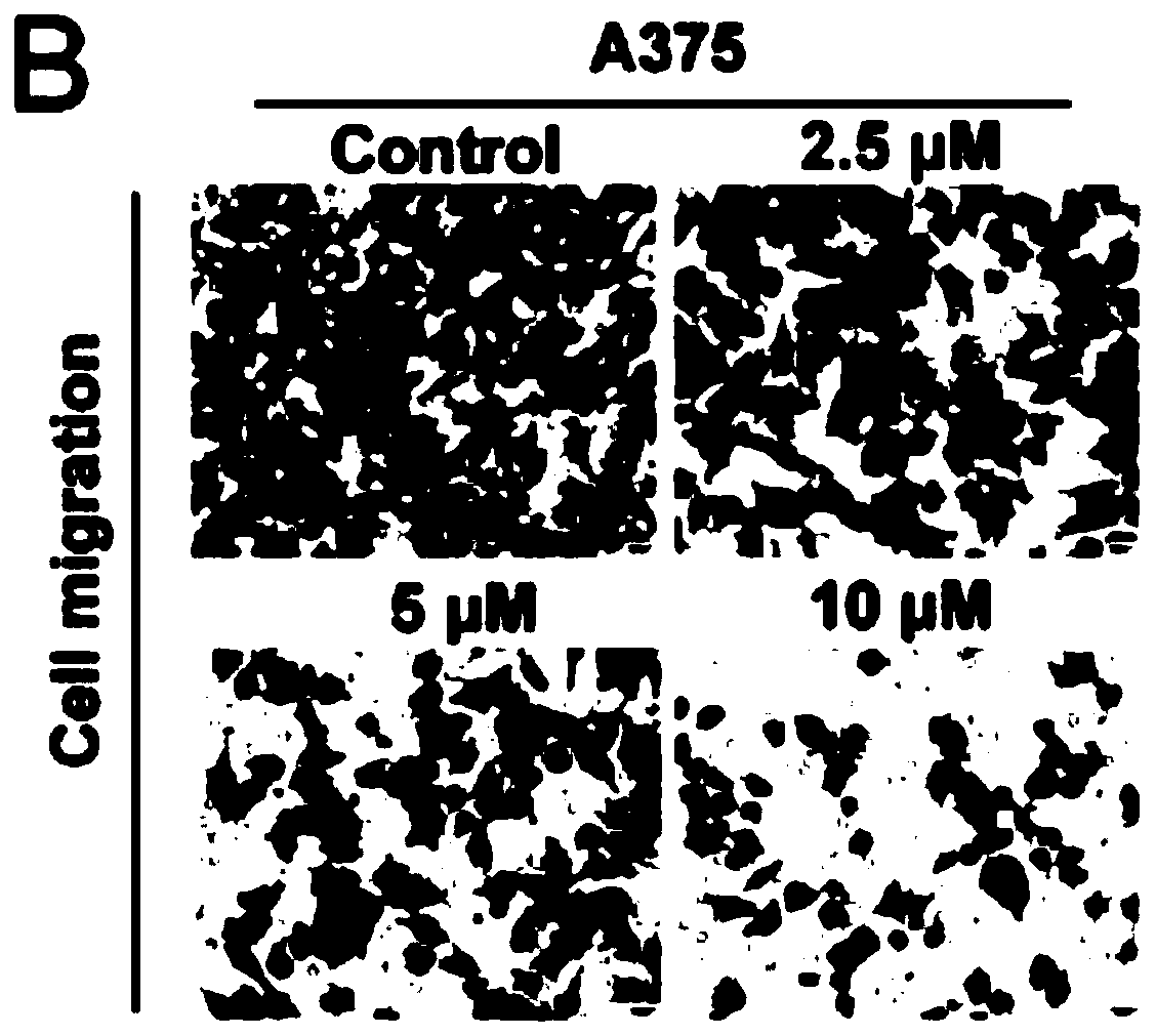 Applications of niclosamide for preventing pulmonary metastasis of malignant melanoma