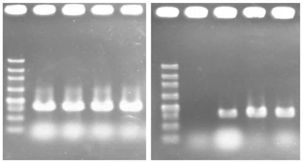 Saccharomyces cerevisiae for industrial production with high organic acid tolerance and construction method thereof