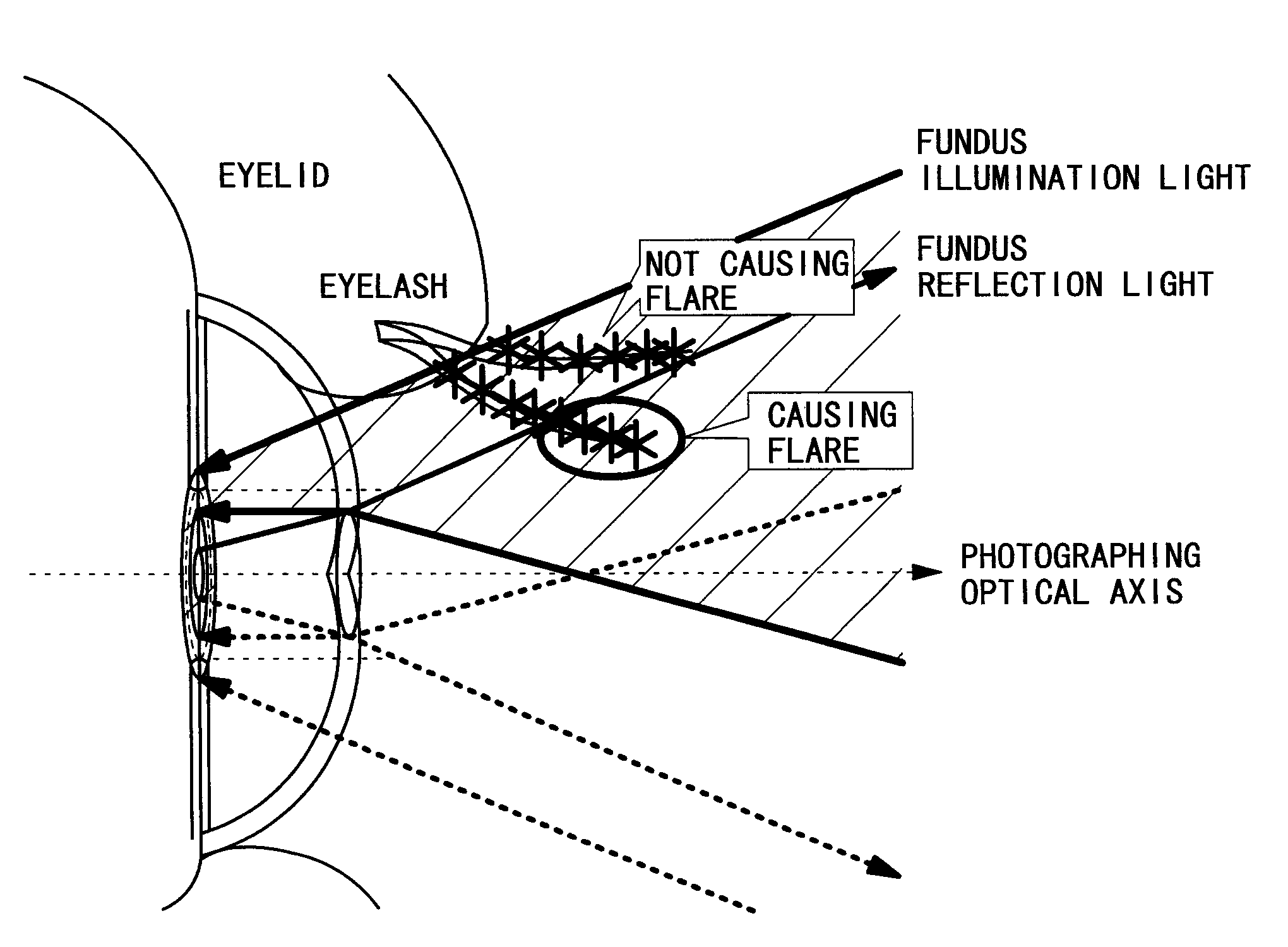 Fundus camera