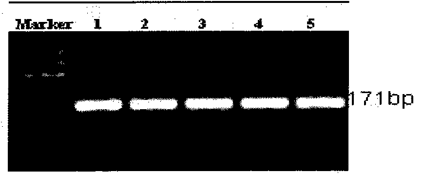 Recombinant human FSHR-57 polypeptide protein and preparation method and application thereof