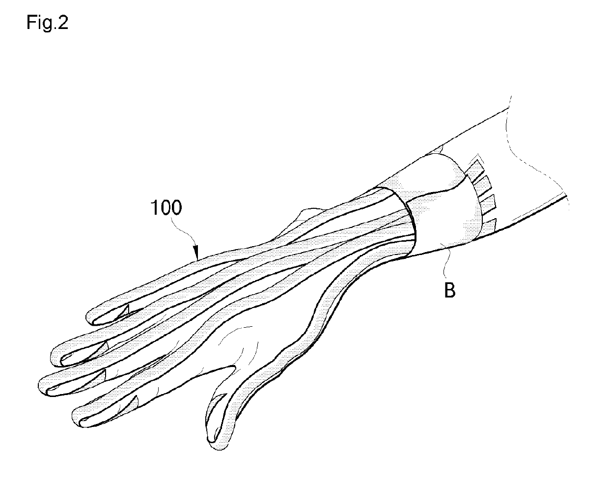 Elastic band for correcting joint deformity and enhancing joint function, and device for mounting same