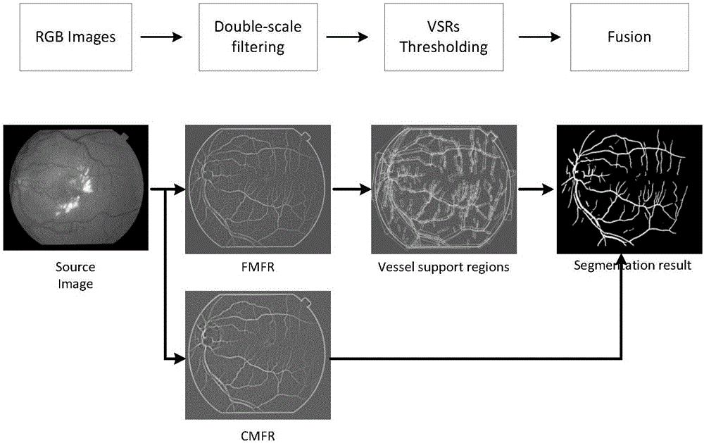 Method for segmenting vasa sanguinea retinae image