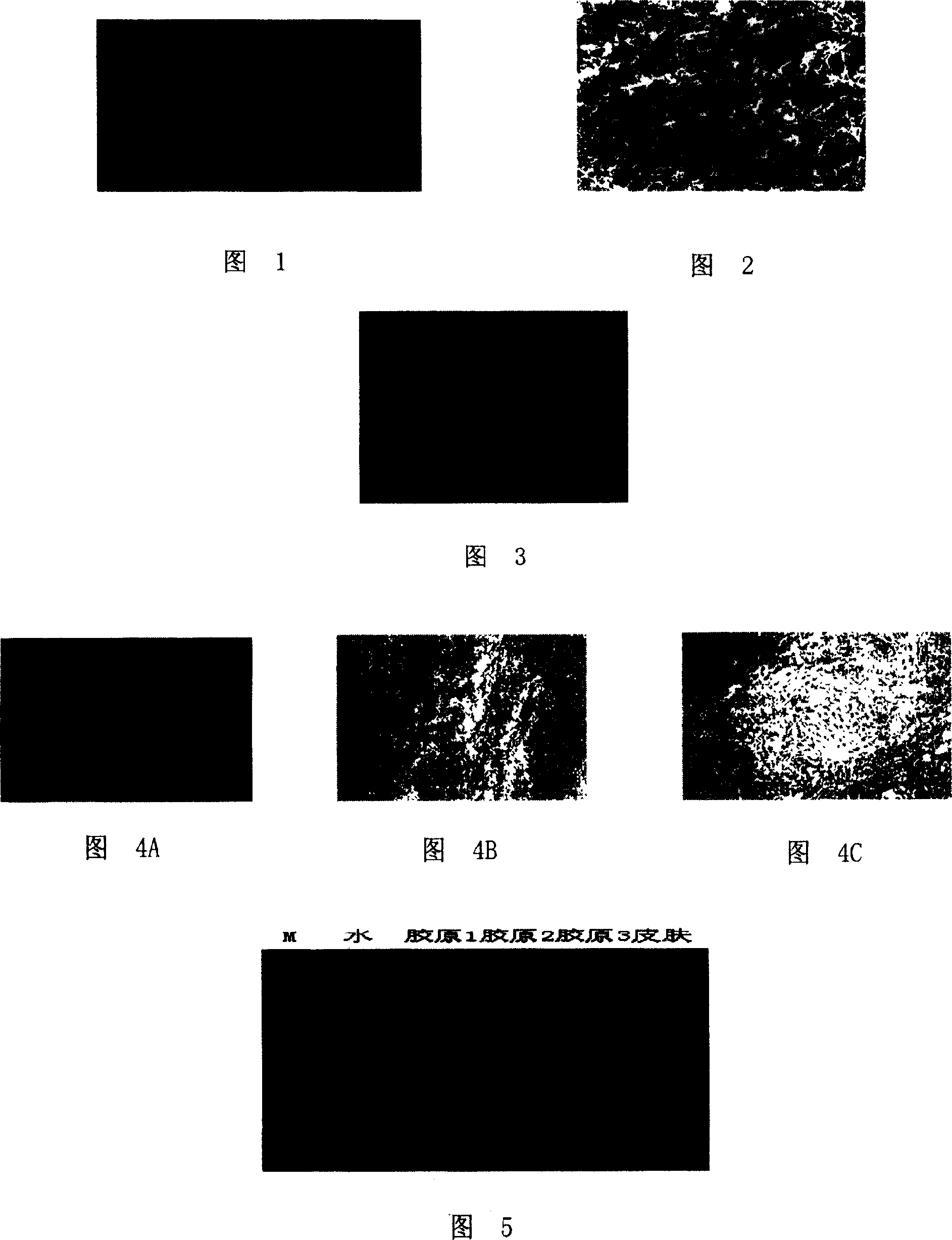 Acellular dermal matrix and its preparing method