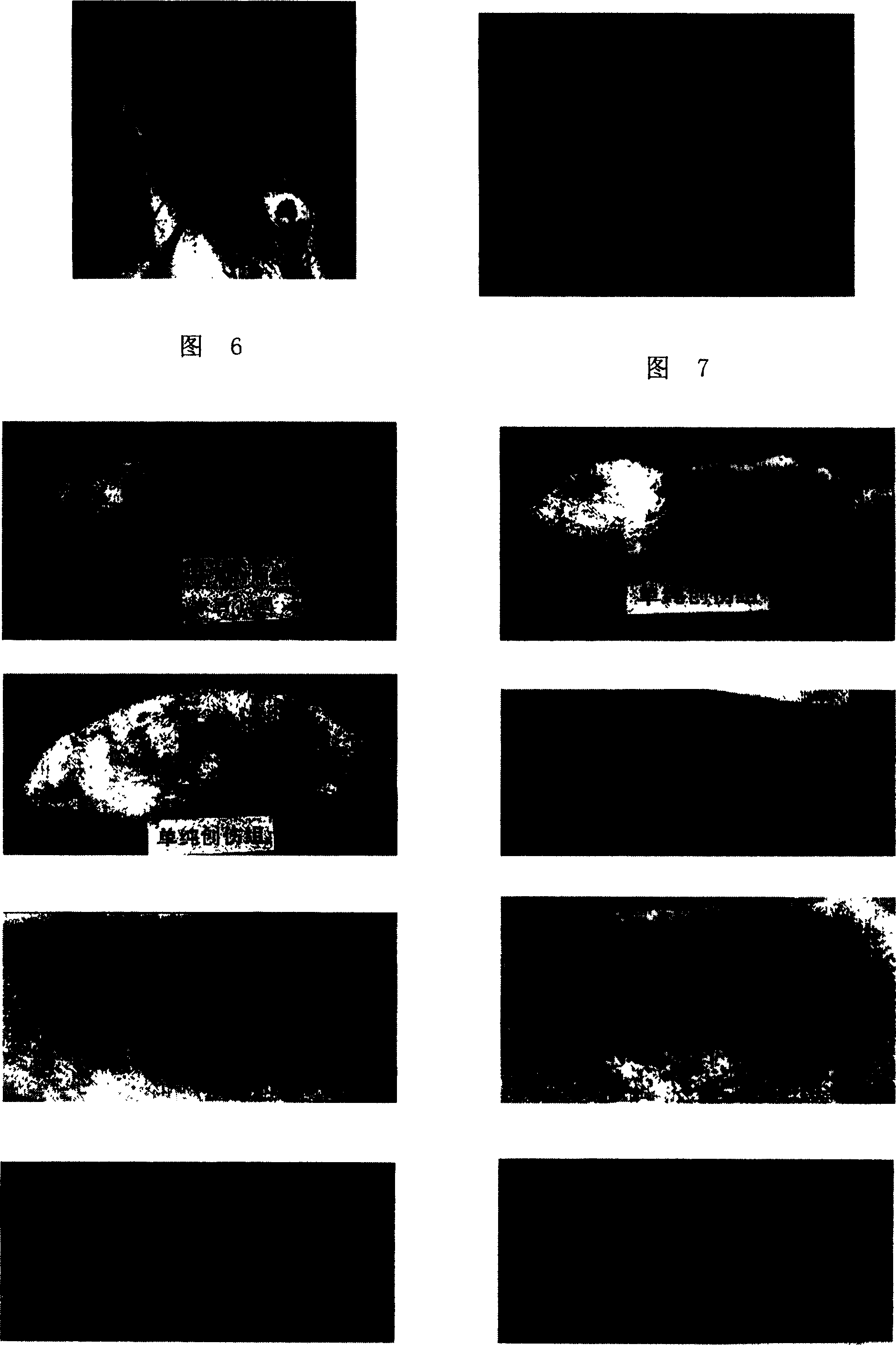 Acellular dermal matrix and its preparing method