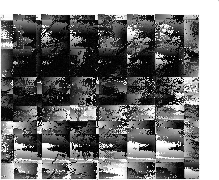 Anti-infection bio-derived hernia and body wall repair material, preparation and application thereof